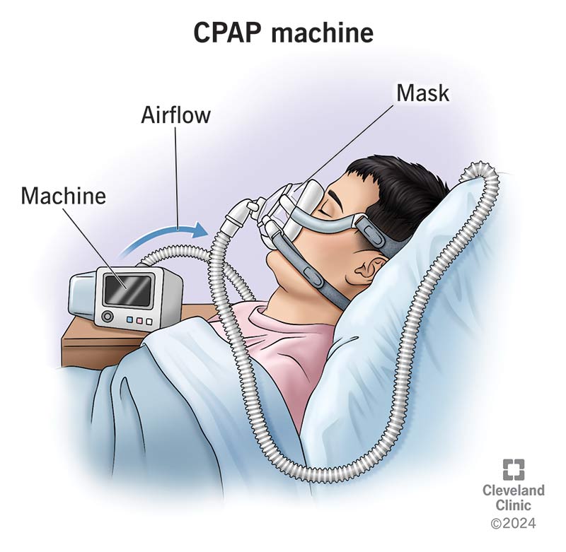 CPAP Machine Components
